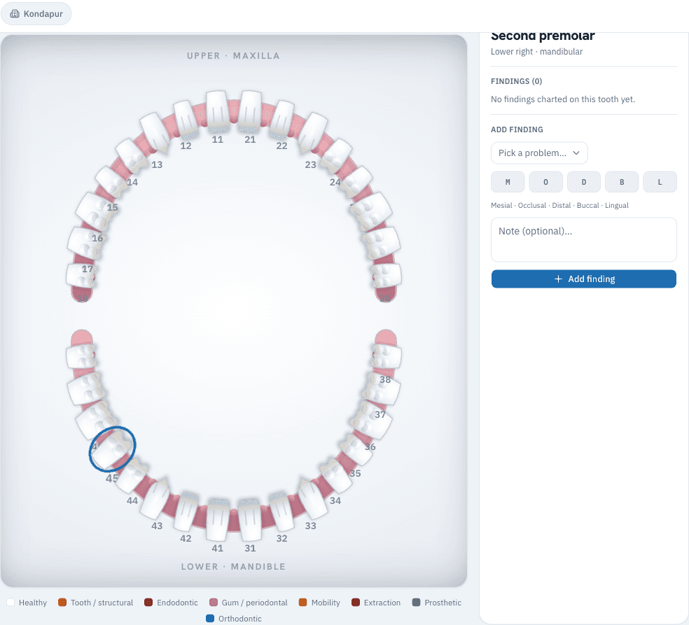 Interactive FDI tooth chart with a per-tooth findings panel and a colour-coded category legend